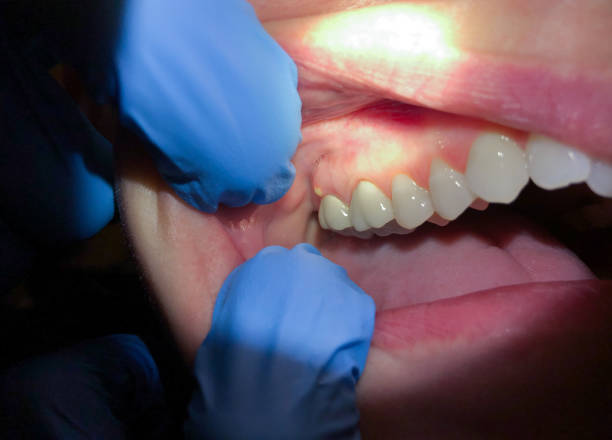 Best Cosmetic Emergency Dentistry in Crosby, MN